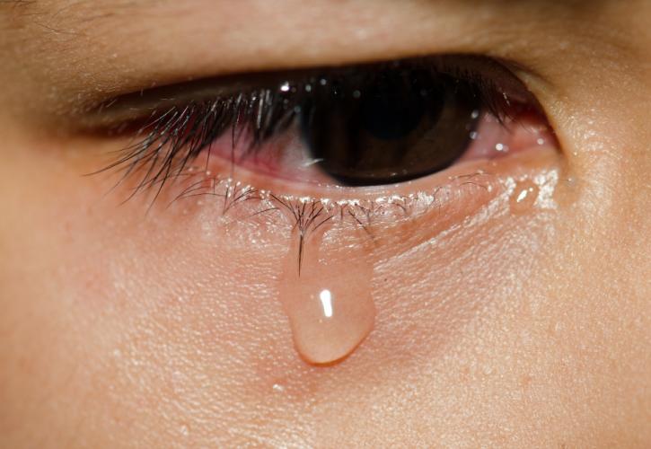 Δακρυοαδενίτιδα: Μια σπάνια αλλά σοβαρή πάθηση των ματιών – Αιτίες και συμπτώματα