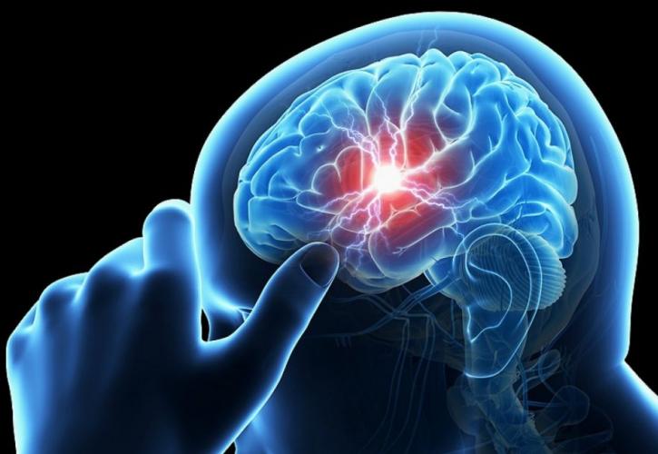 Άμεσα συνδεδεμένες με τα εγκεφαλικά οι νόσοι Πάρκινσον - Αλτσχάιμερ