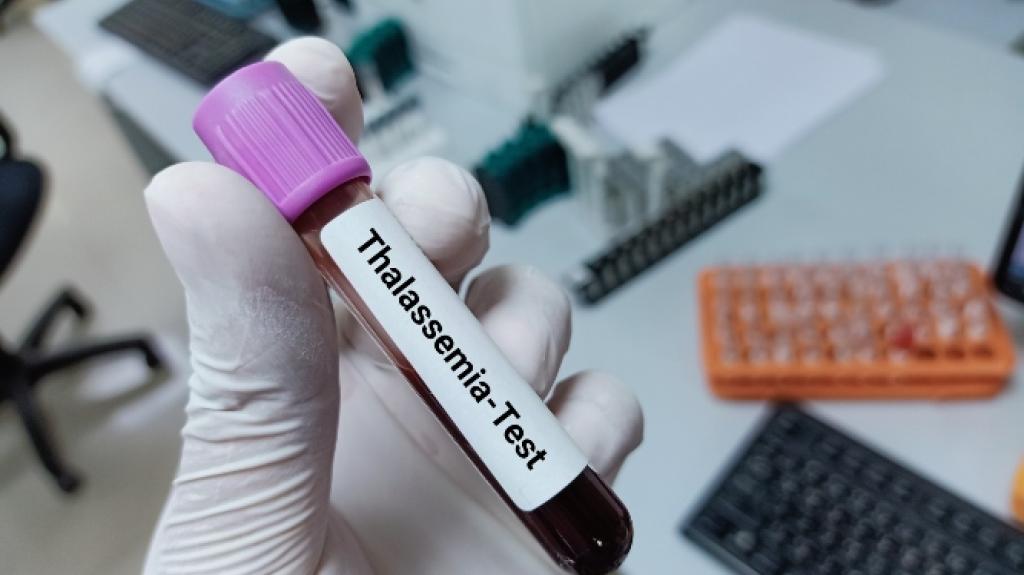 Χρονιά ιστορικής σημασίας για τη θαλασσαιμία