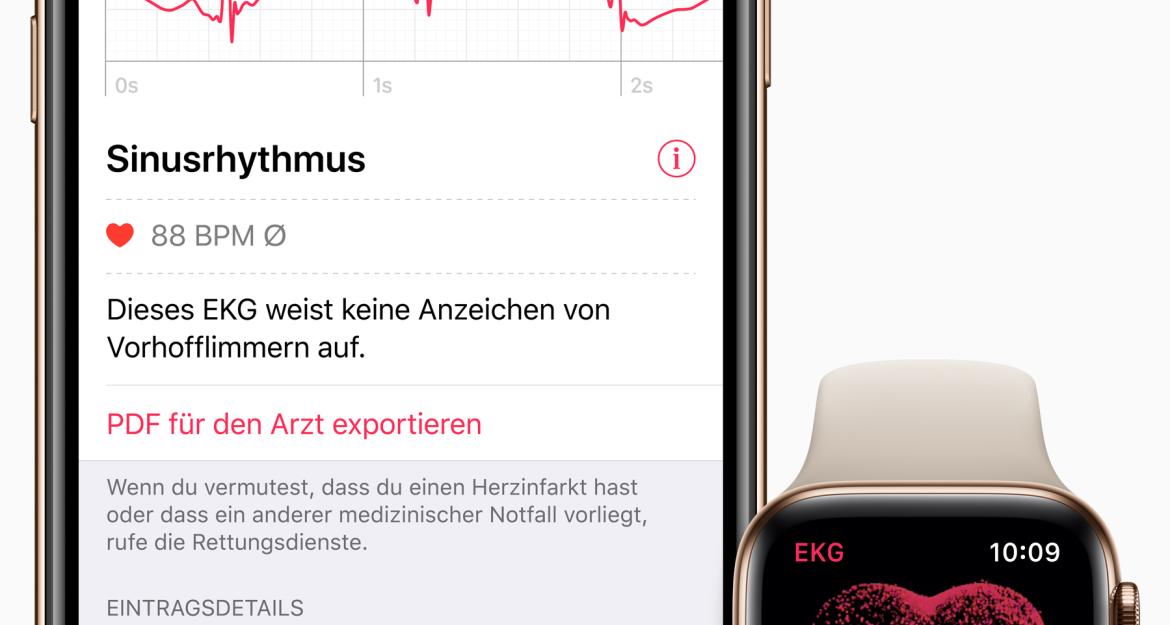 Το ηλεκτροκαρδιογράφημα μέσω Apple Watch τώρα διαθέσιμο και στην Ελλάδα