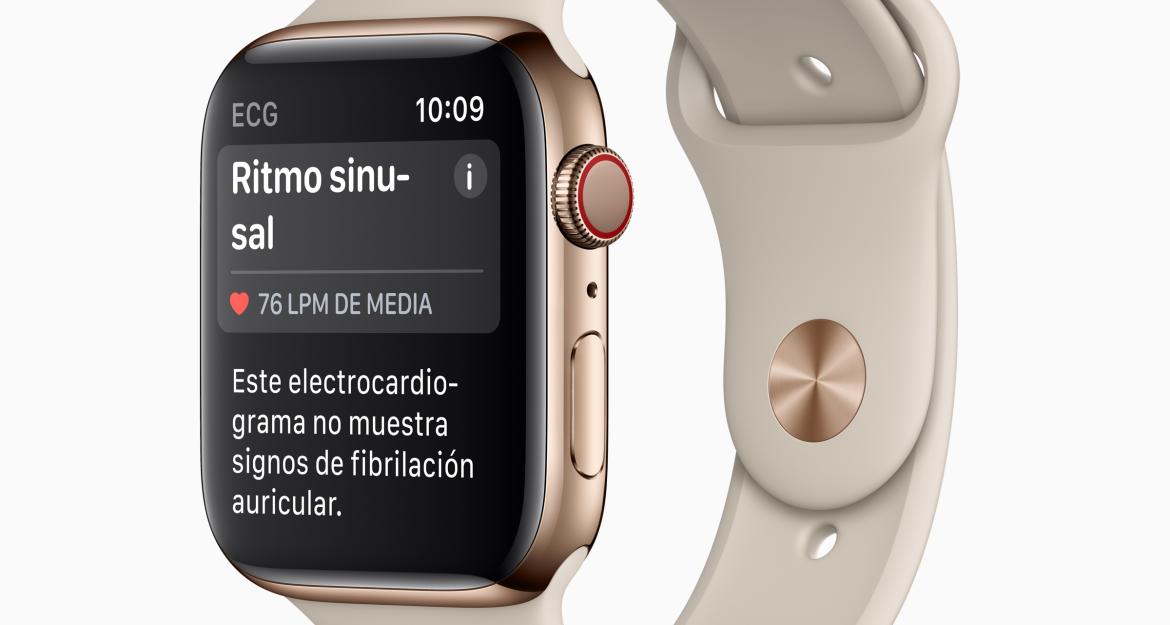 Το ηλεκτροκαρδιογράφημα μέσω Apple Watch τώρα διαθέσιμο και στην Ελλάδα