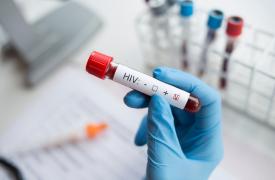 HIV/AIDS: Υπογράφτηκε η Κοινή Υπουργική Απόφαση για την προληπτική χορήγηση αντιρετροϊκών φαρμάκων (PrEP)
