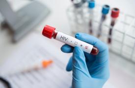 ECDC: Σε 16.637 εκτιμώνται τα άτομα με HIV στην Ελλάδα