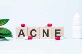 Ακμή ενηλίκων: Ο ρόλος - έκπληξη των μικροβίων