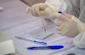 Σε πόσα rapid test υποχρεούνται οι ανεμβολίαστοι εργαζόμενοι