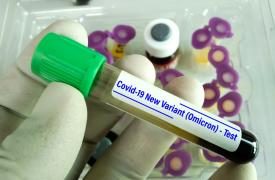 Κορονοϊός: Τα νέα υποστελέχη της Όμικρον εμφανίζουν αυξημένη ικανότητα ανοσολογικής διαφυγής
