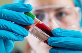 Υγεία: Εξετάσεις αίματος μπορούν να προσδιορίσουν με ακρίβεια τους ασθενείς με long Covid