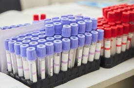 Η γήρανση του πληθυσμού μπορεί να οδηγήσει σε αύξηση των ανθεκτικών βακτηριακών λοιμώξεων αίματος