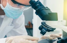 Αύξηση των κρουσμάτων καρκίνου του παχέος εντέρου σε ανθρώπους κάτω των 50 ετών