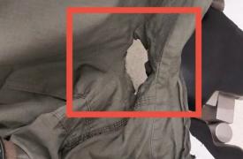 Τρύπα από τη μολότοφ στη στολή του αστυνομικού που τραυματίστηκε στα επεισόδια στο ΑΠΘ