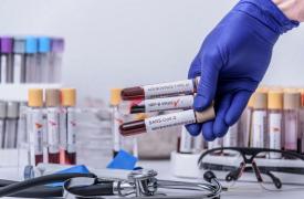 Οι ιογενείς ηπατίτιδες στοιχίζουν τη ζωή σε 1,34 εκατ. ασθενείς ετησίως - Καθυστερεί το πλάνο για την εξάλειψή τους