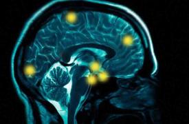 8 σημάδια που μαρτυρούν ότι ένας άνθρωπος έχει υψηλή νοημοσύνη