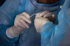 Ηπατίτιδα Α: Έξαρση μολυσματικού στελέχους σε επτά χώρες στην Ευρώπη