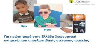ΙΑΣΩ Παίδων: Για πρώτη φορά στην Ελλάδα χειρουργική αντιμετώπιση υπογλωττιδικής στένωσης τραχείας