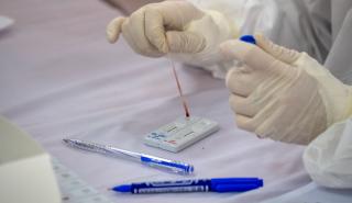 Σε πόσα rapid test υποχρεούνται οι ανεμβολίαστοι εργαζόμενοι