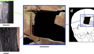 Βρέθηκε κρανίο με τετράγωνη τρύπα – Ένδειξη για χειρουργική εγκεφάλου πριν 3.500 χρόνια