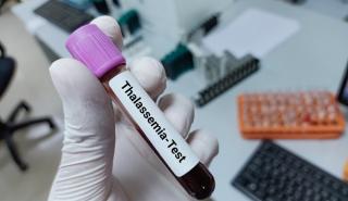 Χρονιά ιστορικής σημασίας για τη θαλασσαιμία