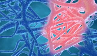 Ερευνητές ανακάλυψαν το φυσικό «φρένο» της φλεγμονής - Τι αλλάζει για πολλές χρόνιες παθήσεις