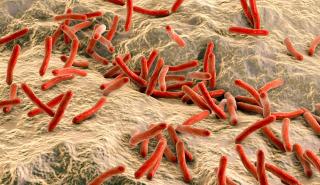 Η λέπρα δεν εξαλείφθηκε ακόμα - 172.717 νέα κρούσματα καταγράφηκαν το 2024