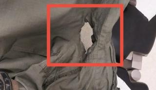 Τρύπα από τη μολότοφ στη στολή του αστυνομικού που τραυματίστηκε στα επεισόδια στο ΑΠΘ