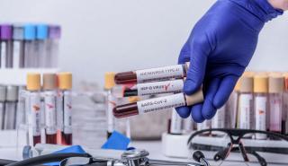 Οι ιογενείς ηπατίτιδες στοιχίζουν τη ζωή σε 1,34 εκατ. ασθενείς ετησίως - Καθυστερεί το πλάνο για την εξάλειψή τους