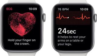 Το ηλεκτροκαρδιογράφημα μέσω Apple Watch τώρα διαθέσιμο και στην Ελλάδα
