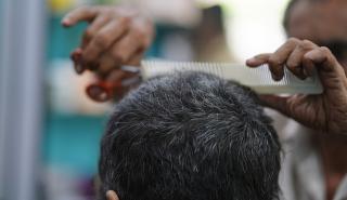 Τζίρο 1 δισ. δολάρια κάνουν οι μεταμοσχεύσεις μαλλιών στην Τουρκία