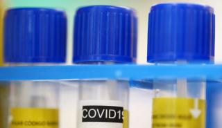 ΗΠΑ: Επίμονα προβλήματα υγείας αντιμετωπίζει 1/4 από όσους ανάρρωσαν από Covid-19