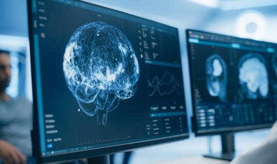 Έρευνα - ορόσημο φωτίζει την διαφορετική ανάπτυξη του εγκεφάλου στο σύνδρομο Down