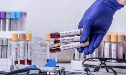 Οι ιογενείς ηπατίτιδες στοιχίζουν τη ζωή σε 1,34 εκατ. ασθενείς ετησίως - Καθυστερεί το πλάνο για την εξάλειψή τους