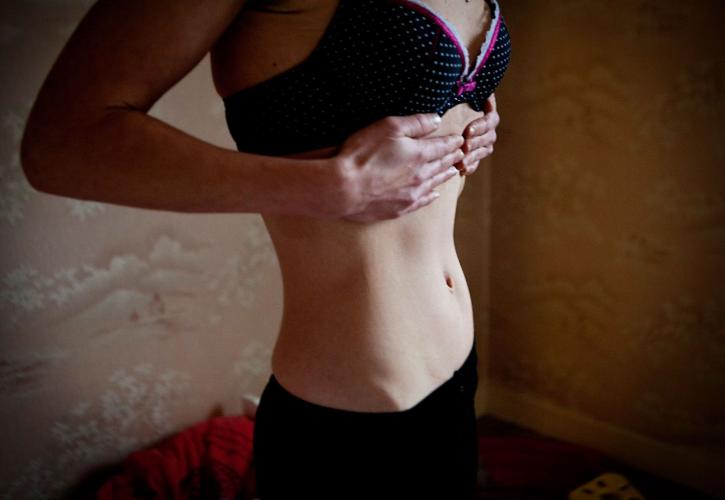 eatingdisorders.anorexia.getty