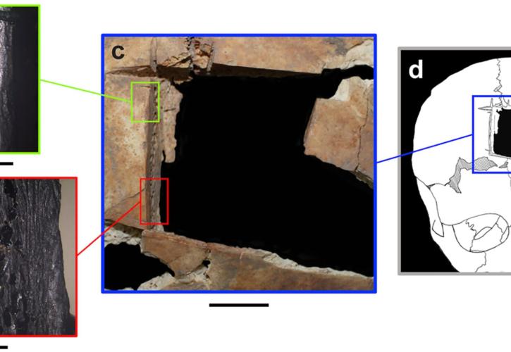 Βρέθηκε κρανίο με τετράγωνη τρύπα – Ένδειξη για χειρουργική εγκεφάλου πριν 3.500 χρόνια