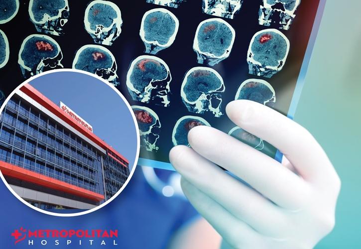 Τεχνητή Νοημοσύνη για την Αντιμετώπιση Εγκεφαλικών Επεισοδίων στο Metropolitan Hospital