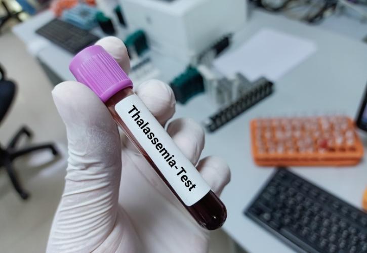 Χρονιά ιστορικής σημασίας για τη θαλασσαιμία