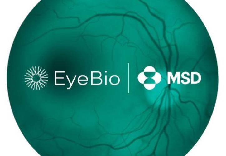 Η MSD ανακοίνωσε την εξαγορά της EyeBio μέσω θυγατρικής