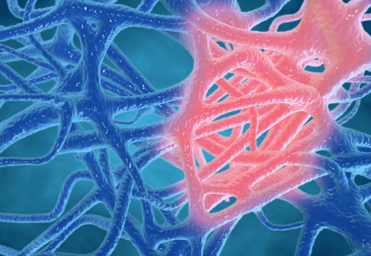 Ερευνητές ανακάλυψαν το φυσικό «φρένο» της φλεγμονής - Τι αλλάζει για πολλές χρόνιες παθήσεις