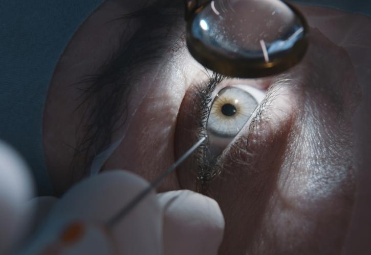 ΠΟΥ: Οι μισοί από τους 94 εκατ. ανθρώπους που πάσχουν από καταρράκτη δεν έχουν πρόσβαση σε χειρουργική επέμβαση