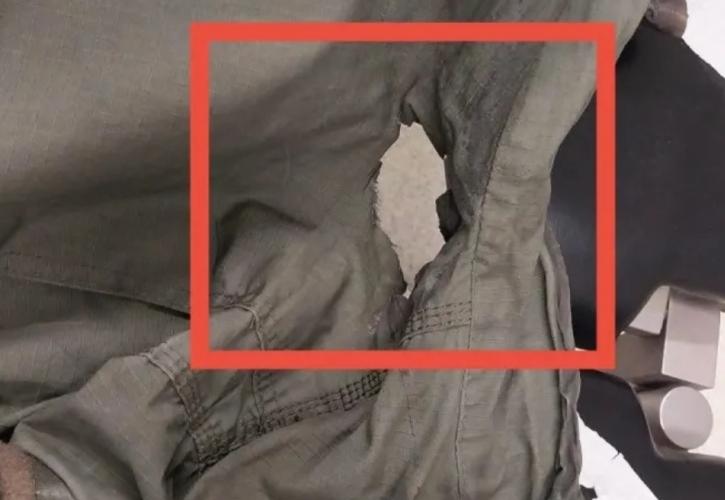 Τρύπα από τη μολότοφ στη στολή του αστυνομικού που τραυματίστηκε στα επεισόδια στο ΑΠΘ