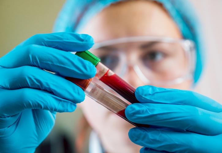 Διαθέσιμη εντός του 2022 εξέταση αίματος που ανιχνεύει τον καρκίνο