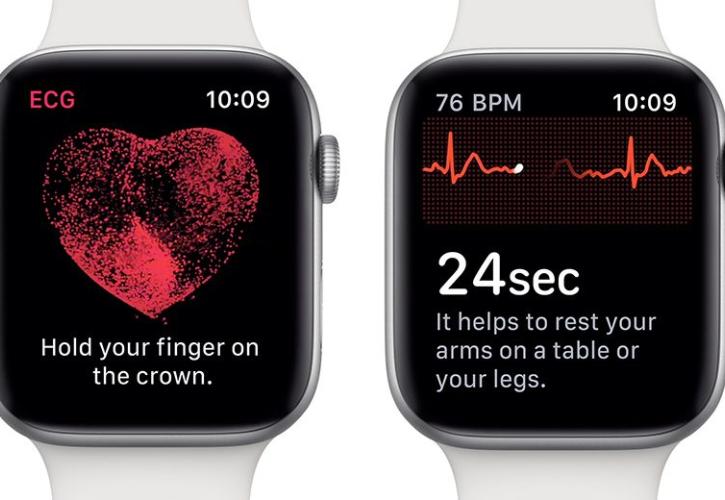 Το ηλεκτροκαρδιογράφημα μέσω Apple Watch τώρα διαθέσιμο και στην Ελλάδα