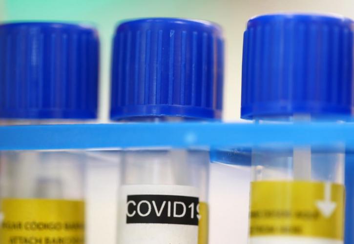 ΕΕ: Συμφωνία με την GSK για την προμήθειας ερευνητικής θεραπείας κατά της COVID-19